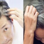 If you know the reason for gray hair starting at an early age, you will be able to save the remaining hair.