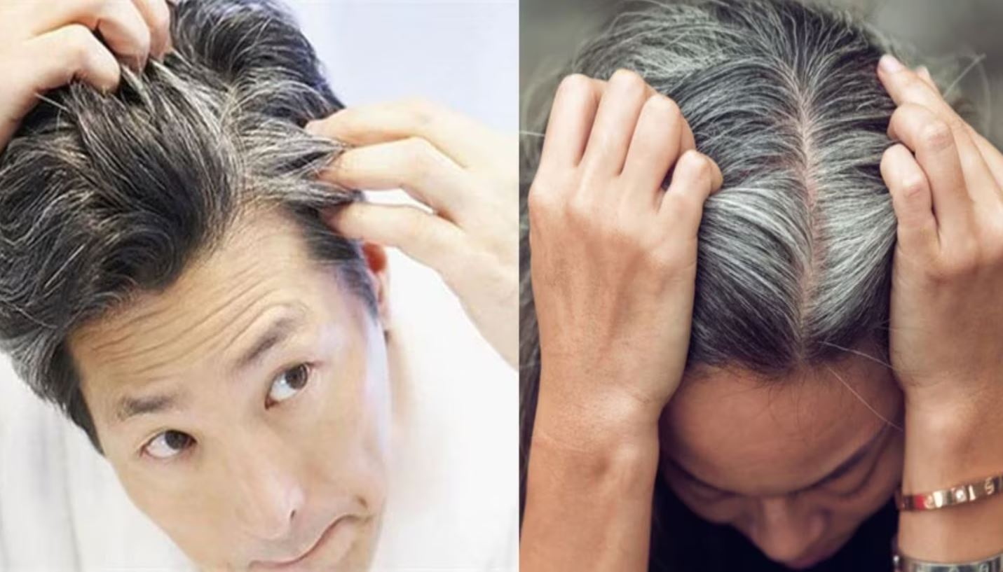 If you know the reason for gray hair starting at an early age, you will be able to save the remaining hair.