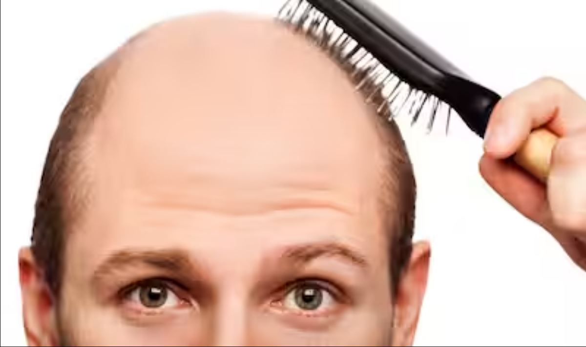 Are you worried about baldness? Do these 6 things daily, hair will start growing again