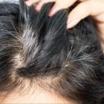 You start looking old in your youth, get rid of gray hair and facial wrinkles in this way