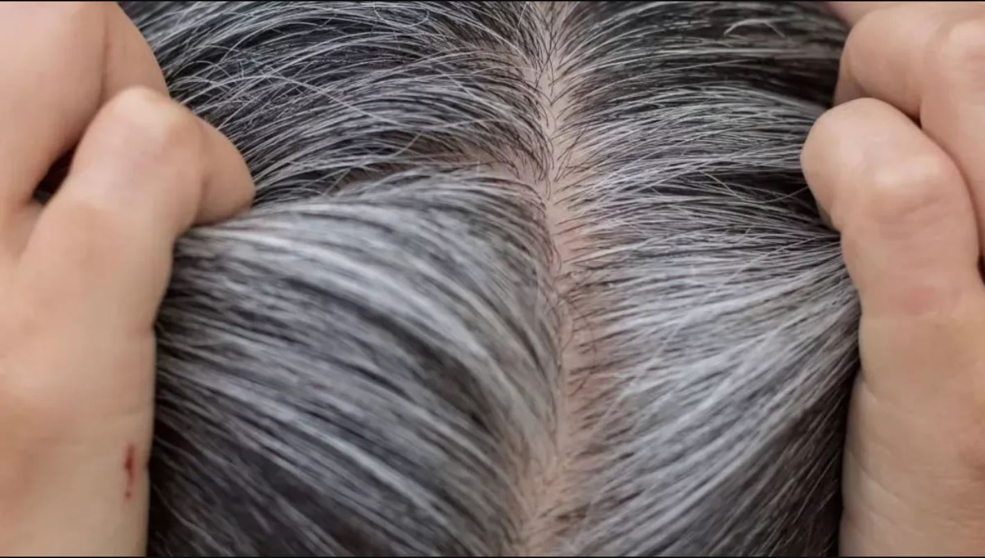 White hair will turn black in a few days by using these 2 things, the ingredients will be available at your home.