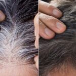Blacken white hair forever with this peel, hair will become thick and black without spending money.