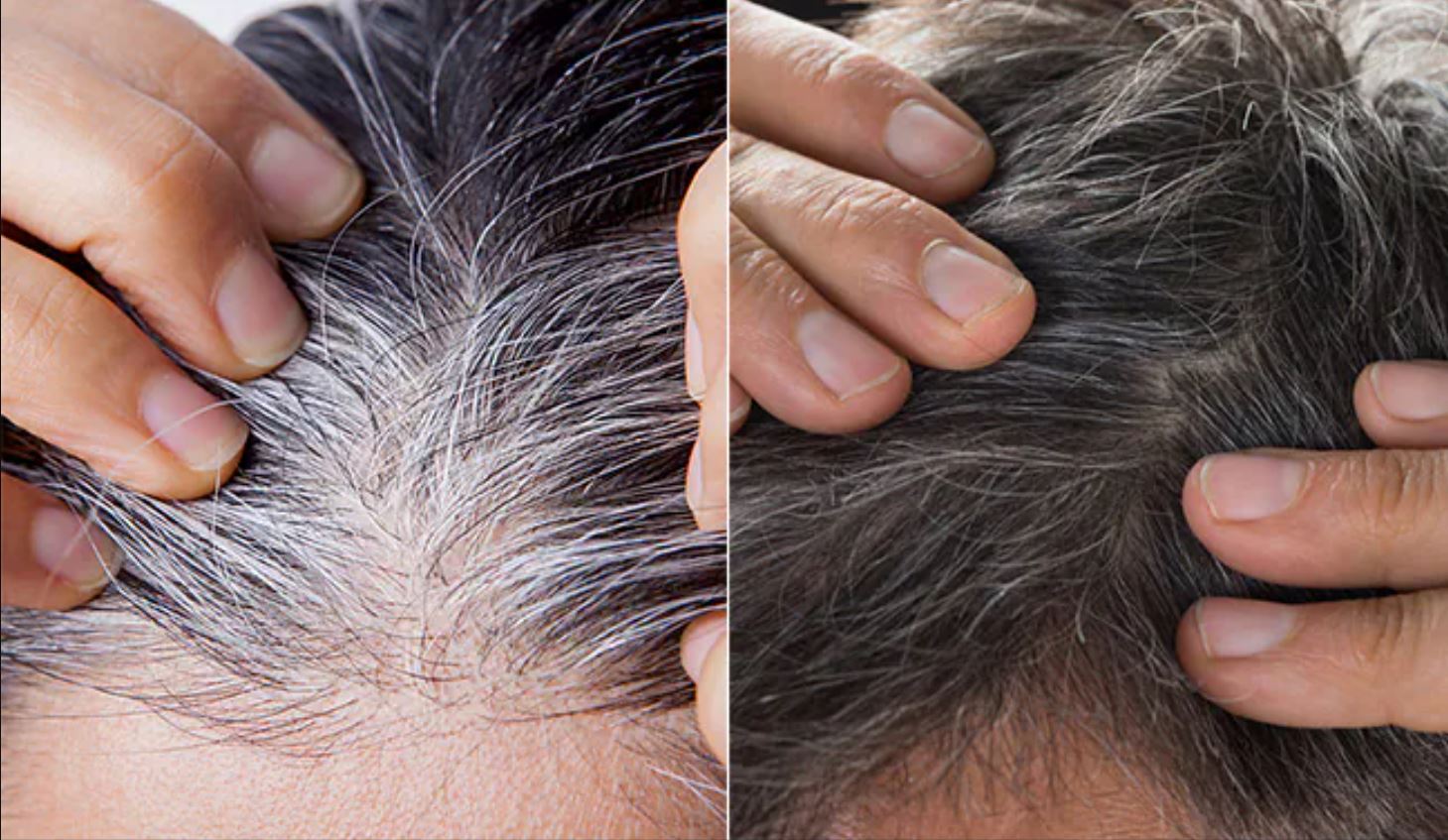 Blacken white hair forever with this peel, hair will become thick and black without spending money.