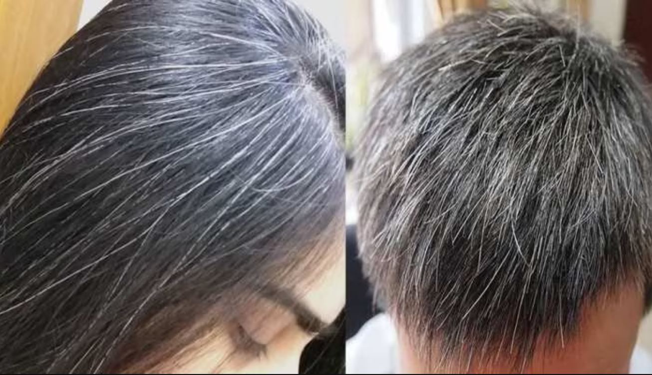 Increase this 1 thing in your body, you will get relief from the problem of white hair soon, know what to do?