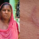 Bundi: Miscreants broke the gold chain around a woman's neck in broad daylight, the victim fought with the miscreants and drove them away with stones.