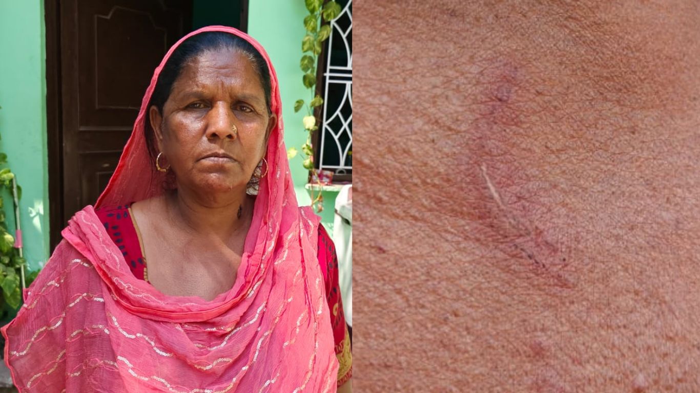 Bundi: Miscreants broke the gold chain around a woman's neck in broad daylight, the victim fought with the miscreants and drove them away with stones.
