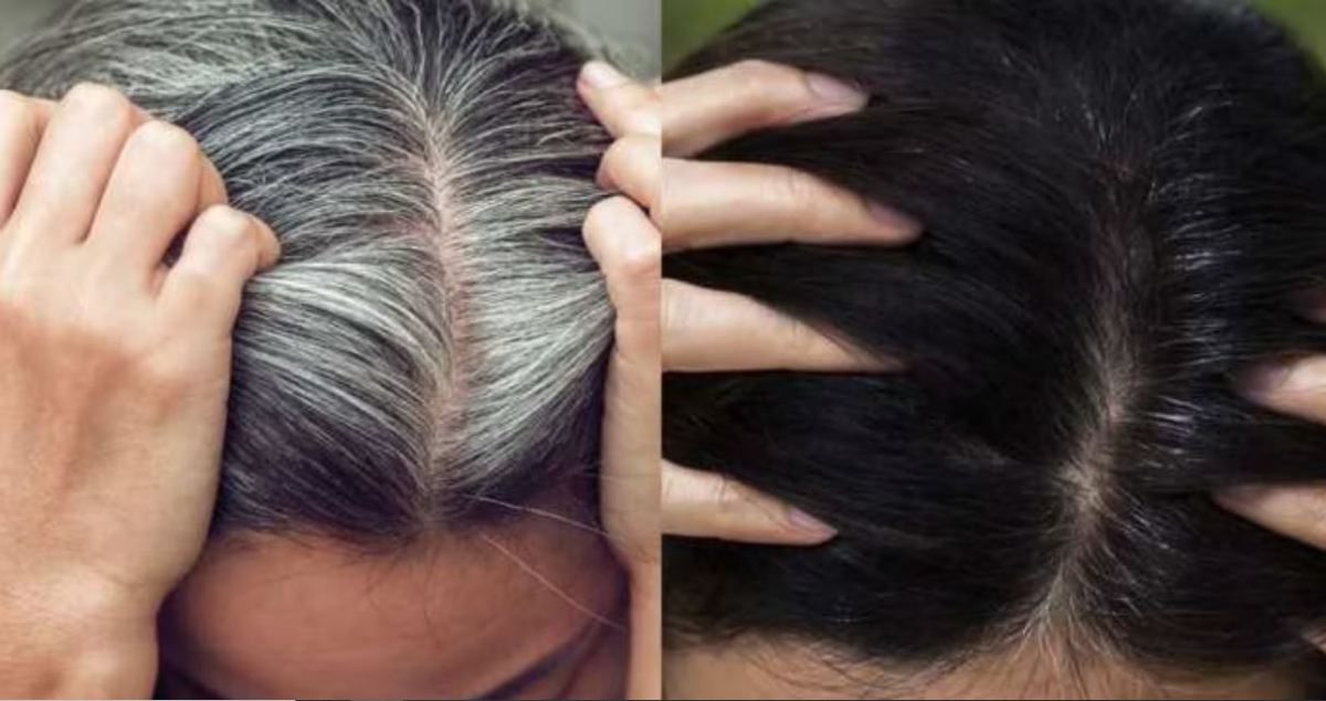Darken Hair Naturally: Evergreen solution to the problem of white hair, this home remedy will give you black hair.