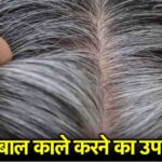 White Hair Home Remedy: Keep hair naturally black with Ayurvedic remedies, know the simple solution