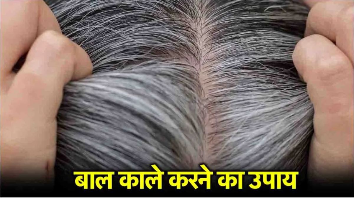 White Hair Home Remedy: Keep hair naturally black with Ayurvedic remedies, know the simple solution