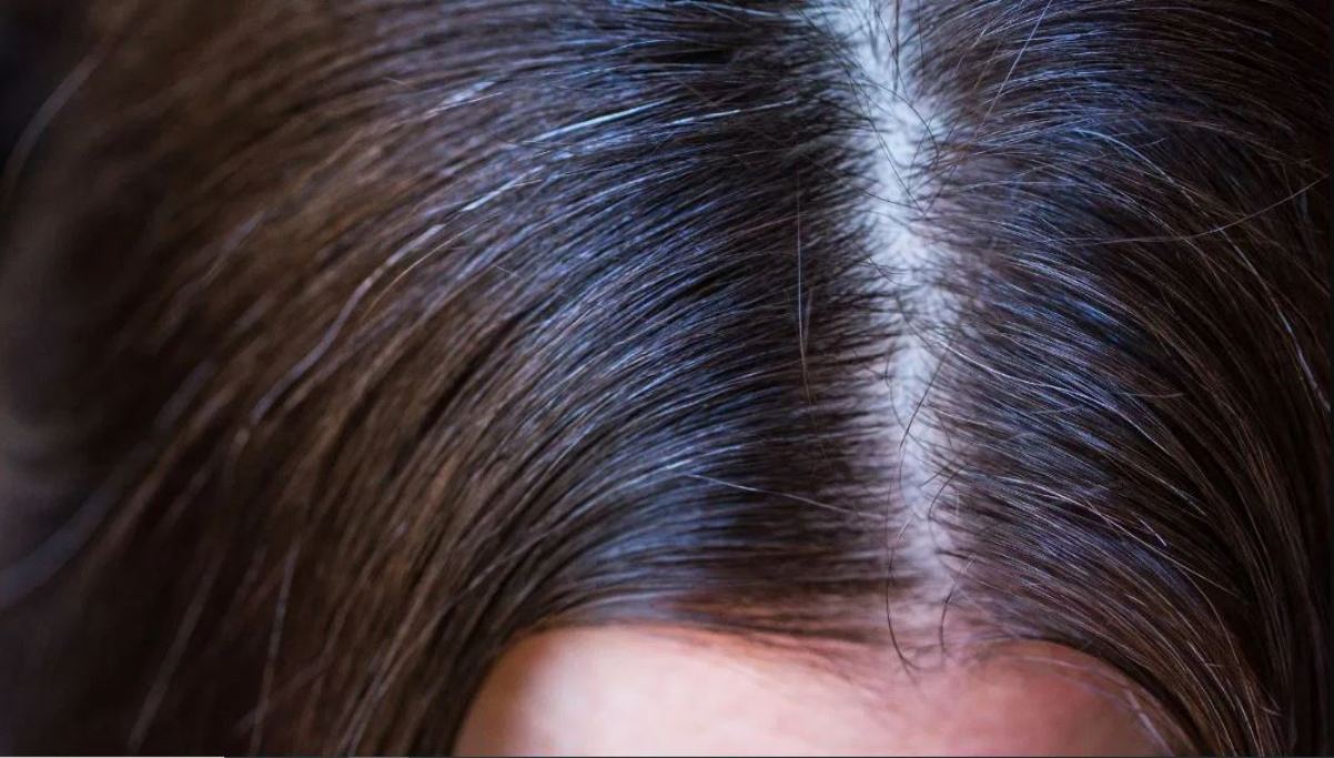 Can gray hair ever turn black? AI gave this answer