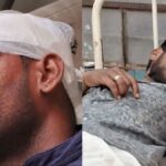 There was a fight over payment at the Dhaba, the police team was attacked, 5 people including ASI were injured